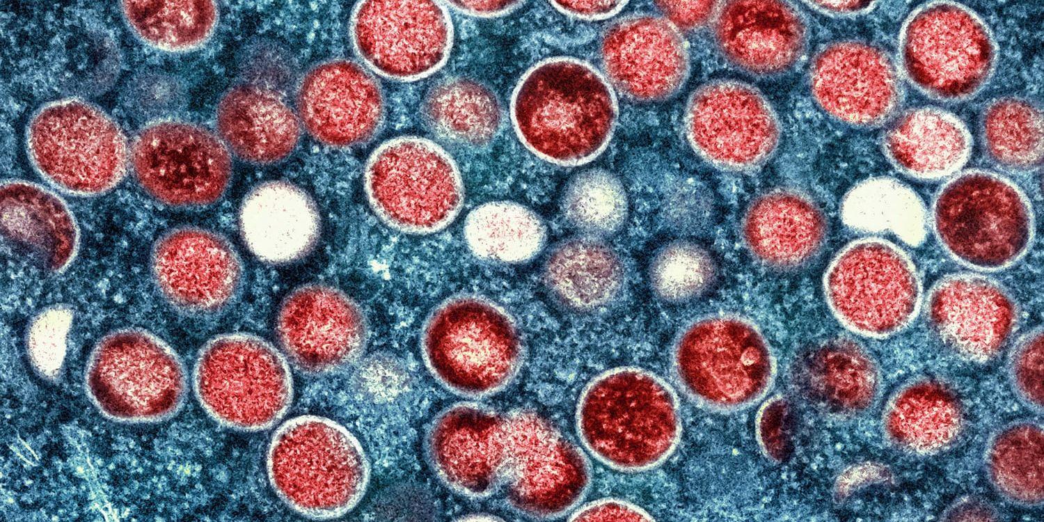 Mpox, som tidigare kallades apkoppor, sprider sig i Afrika. Här syns mpox-partiklar (röda) i en infekterad cell. Arkivbild.